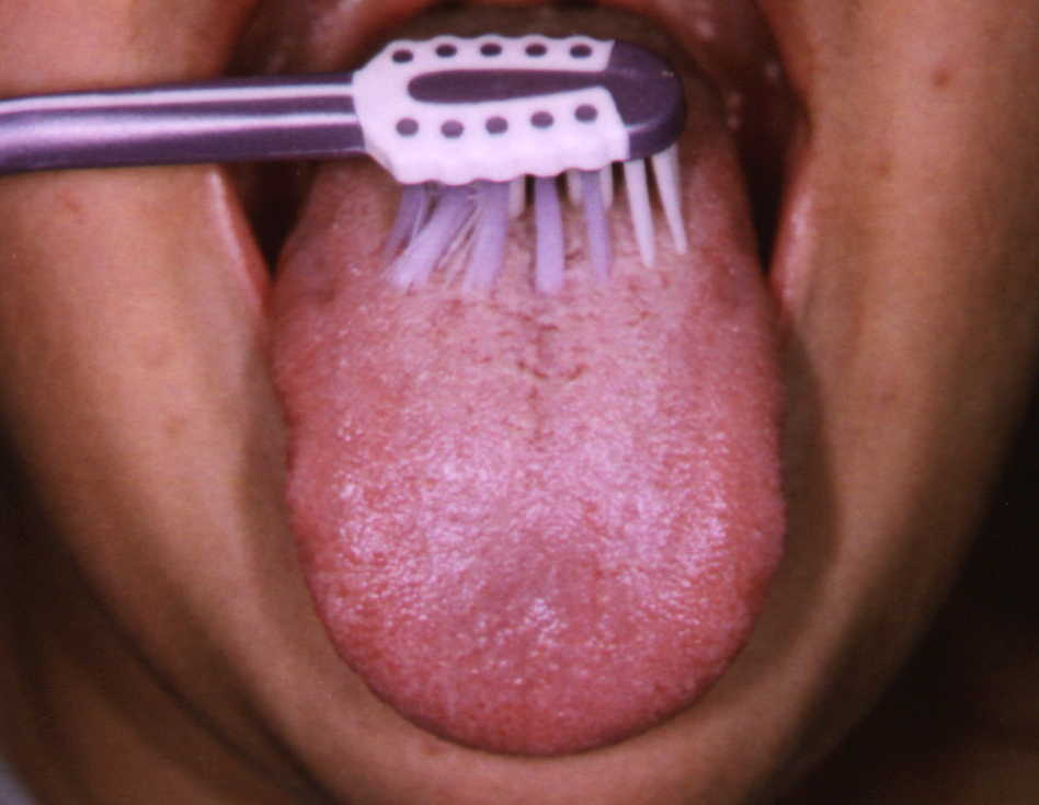 brushing-your-tongue