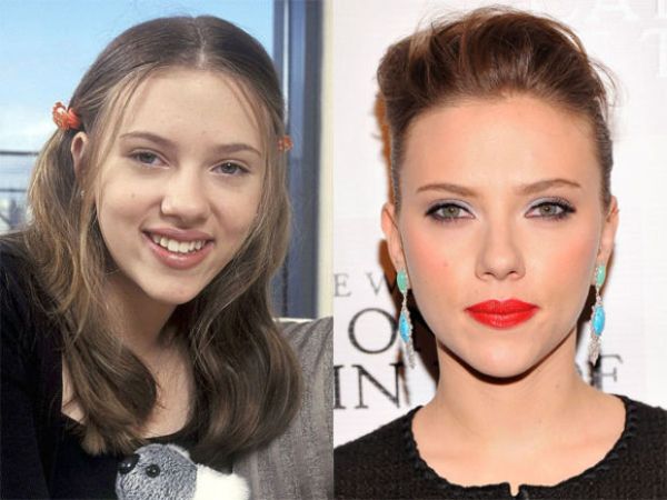 Scarlett-Johansson-nose-job-before-and-after