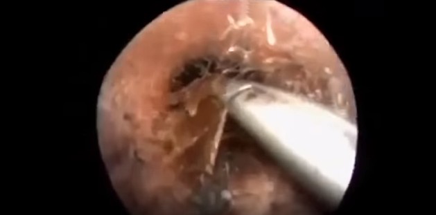 Screen Shot 2016-07-21 at 11.16.19 AM