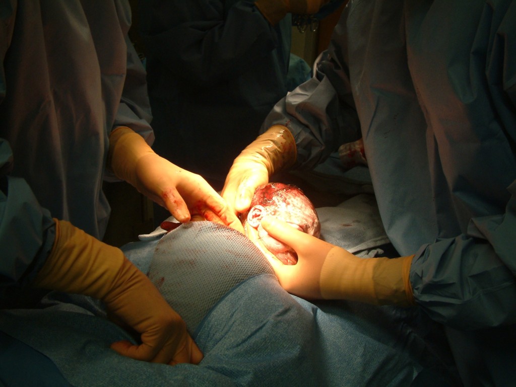 childbirth_c._Todd_Anderson,_Flickr_Commons