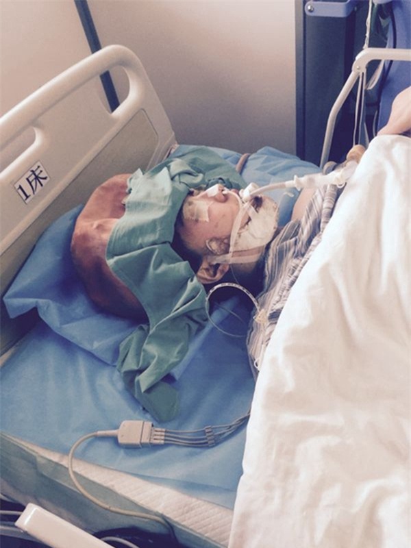 nu-thac-si-xinh-dep-va-thanh-dat-bi-dong-kinh-sau-khi-phau-thuat-tham-my-got-ham_3