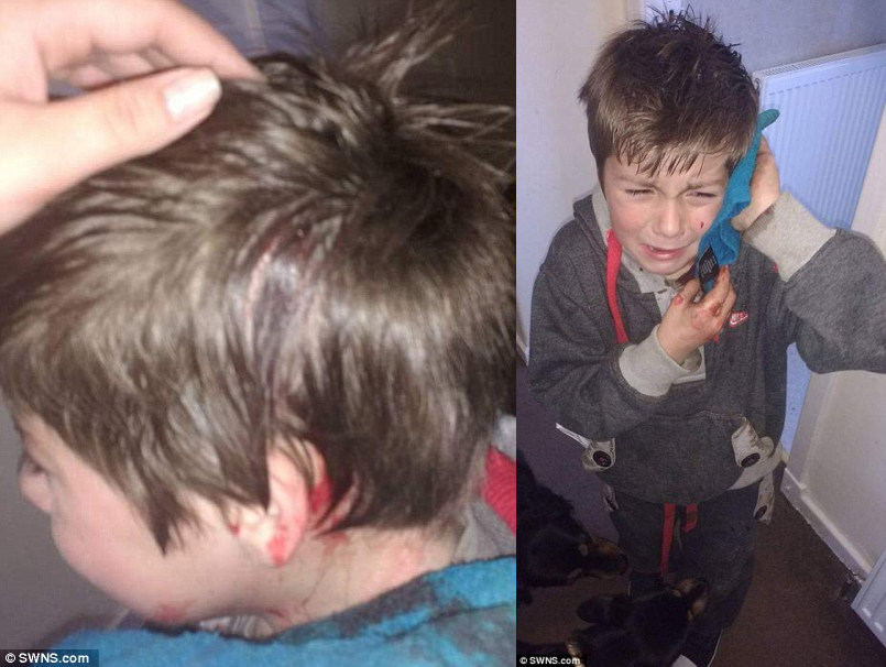 7歲男孩被霸凌到頭破血流，「看起來兇猛」40名暴走族衝上前「最溫柔手法」摧毀惡霸！