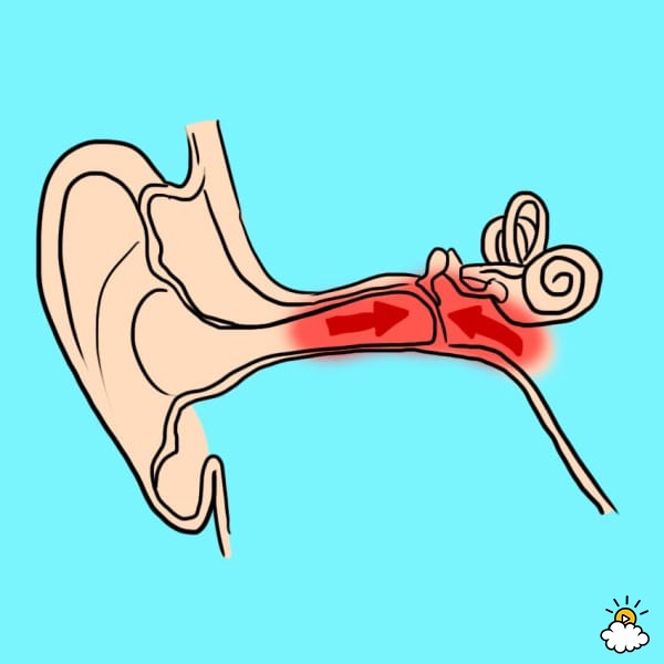 5個一忽略就讓你年輕就失聰的「耳朵痛重要警訊」，#3你有耳朵出水嗎？