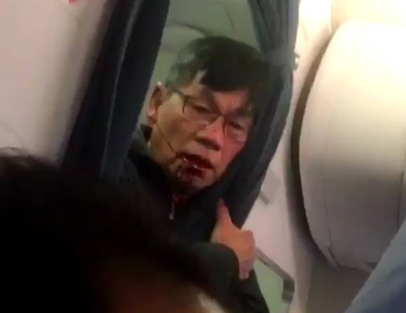 联航殴打乘客事件中的男子身分曝光！被请下飞机的原因就是因为「票种不一样」！