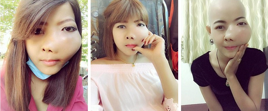 %e6%b3%b0%e6%ad%a3%e5%a6%b9%e8%87%89%e5%b7%a8%e5%a4%a7%e8%85%ab%e7%98%a4%e8%a1%9d%e5%87%ba%e9%bc%bb%e5%ad%94%e5%98%b4%e5%b7%b4