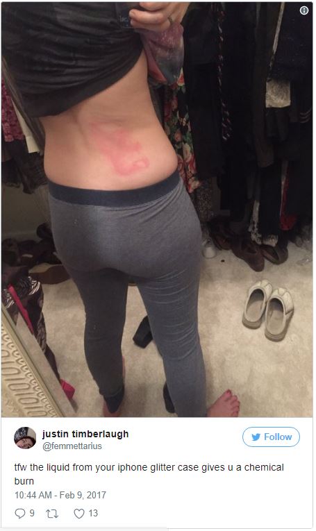 %e6%89%8b%e6%a9%9f%e6%ae%bc%e7%87%92%e5%82%b7