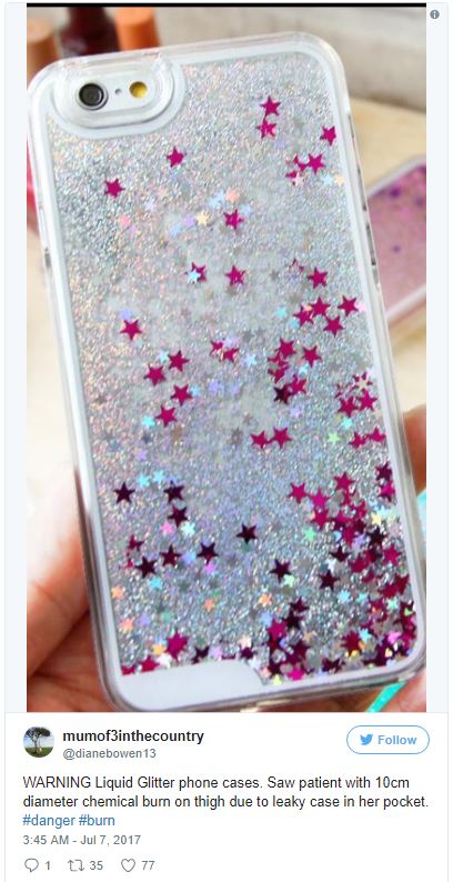 %e6%89%8b%e6%a9%9f%e6%ae%bc%e7%87%92%e5%82%b7