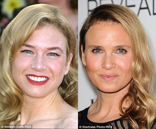 不過要比較起來，另一名女星芮妮·齊薇格 (Renee Zellweger) 的臉部變化，才是最讓人驚訝的呀！