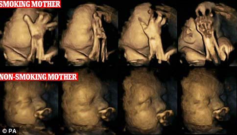最新超音波影像揭露了，比較起媽媽沒吸菸的寶寶，媽媽吸菸的寶寶會比較常去觸碰他們的嘴巴還有臉蛋。而一般來說，當胚胎發育的比較完全後，他們會比較少去觸碰自己的嘴巴和臉部。專家也對此做出推論，若母親在懷孕的時候抽菸，會導致孩子的中樞神經系統發育遲緩。