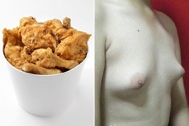Mans-breasts-enlarge-after-eating-fried-chicken