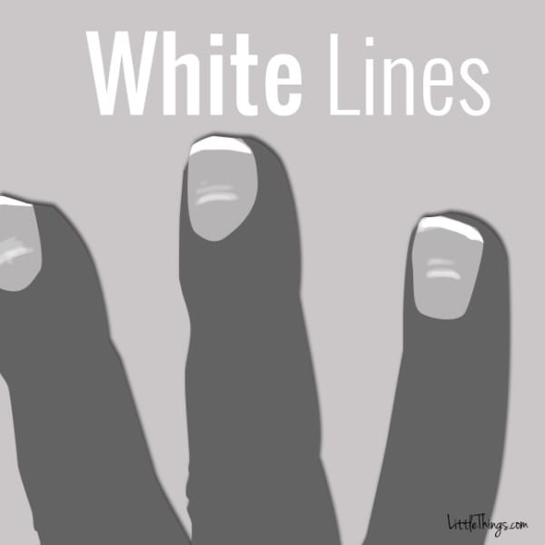 whitelines