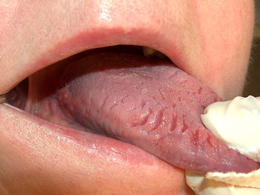 04-tongue-health-wrinkles-sl