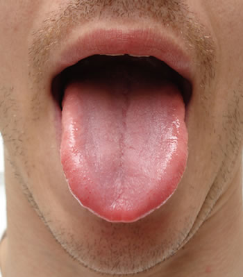 tongue-5