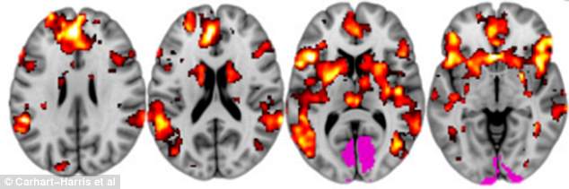 3310783200000578-3534303-A_total_of_20_participants_received_either_an_injection_of_LSD_o-a-124_1460390836458