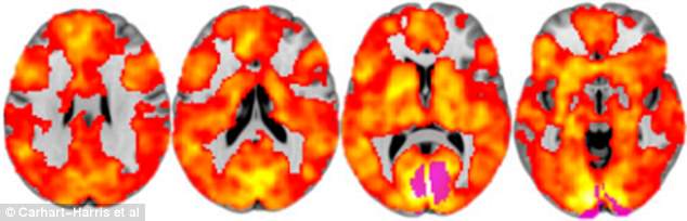 3310783200000578-3534303-The_controversial_study_found_people_experiencing_drug_induced_h-a-125_1460390839316