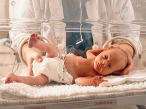 premature-infant-300x225