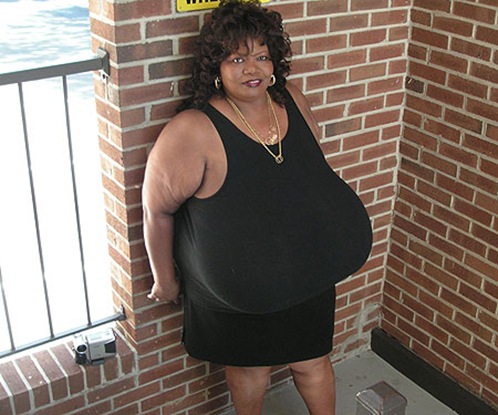 World's Largest Natural Breasts (Norma Stitz) 02[3]