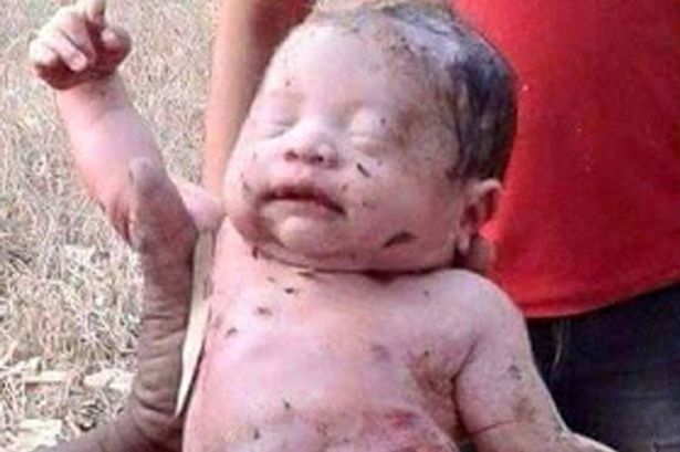 thai-baby-boy-left-for-dead-saved-from-a-shallow-grave