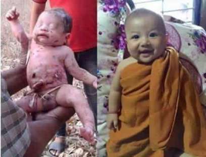 the-rescued-child-in-before-and-after-photo