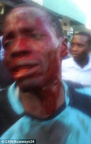 3a9f0ff500000578-3957320-moses_mushonga_was_left_bloodied_and_bruised_pictured_after_he_d-a-115_1479738987190
