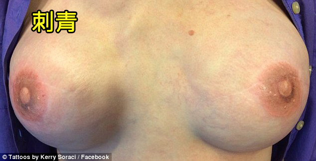 她帮乳癌患者「刺上乳头刺青」被检举删照！脸书糗出面道歉！