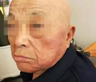 看護「3小時甩57下巴掌」打腫老人 假掰跪哭:那是在玩% 照片 看護「3小時甩57下巴掌」打腫老人 假掰跪哭:那是在玩