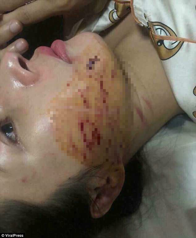 %e5%b0%8f%e4%b8%89%e8%a2%ab%e6%89%93-2