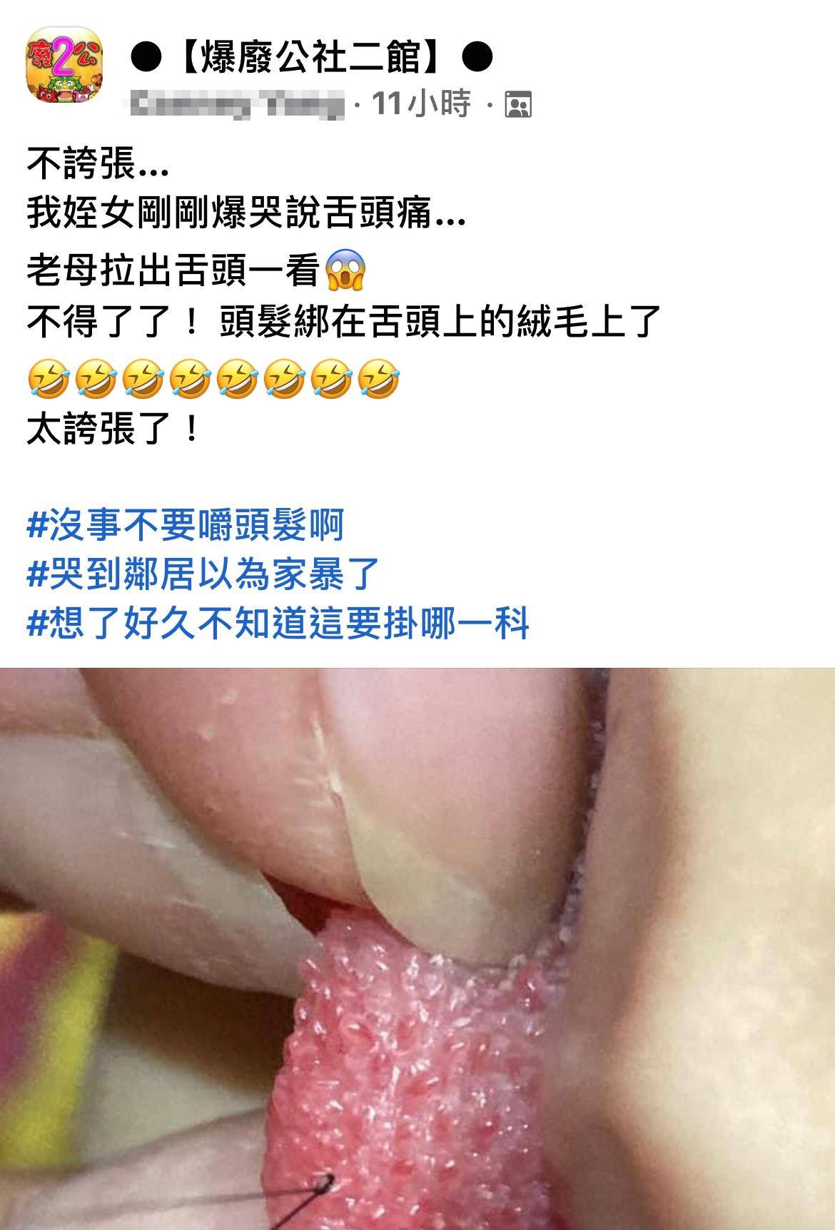 头发绑舌头